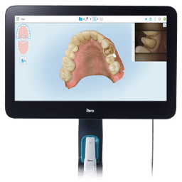 Intraoralscan
